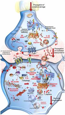 The Neuroanatomy of the Reticular Nucleus Locus Coeruleus in Alzheimer’s Disease